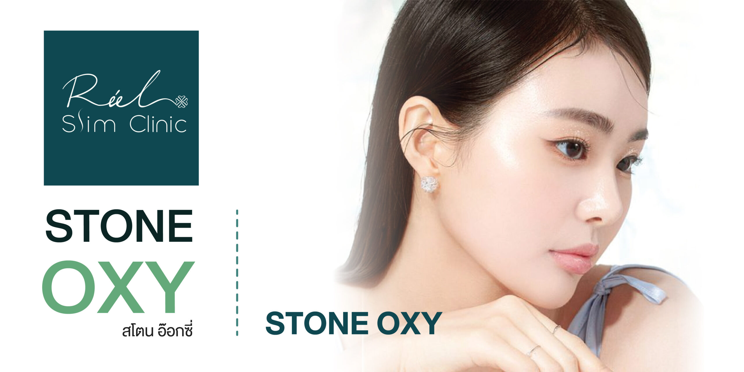 stone oxy