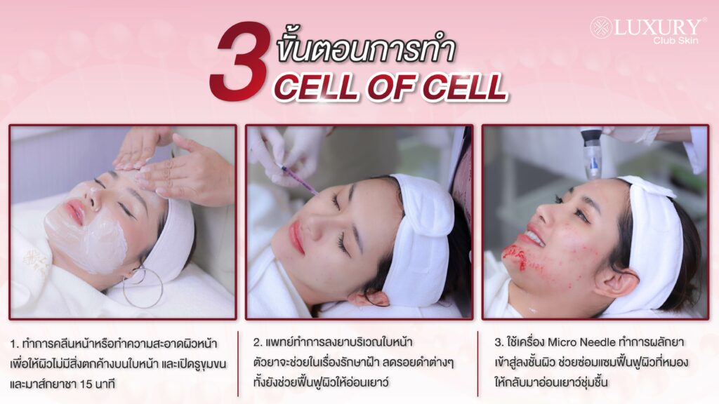 3 ขั้นตอนการทำ cell of cell