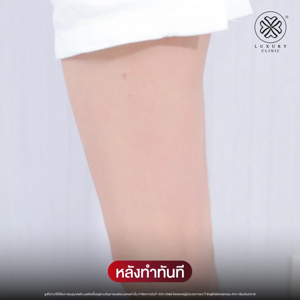 หลังทำทันที