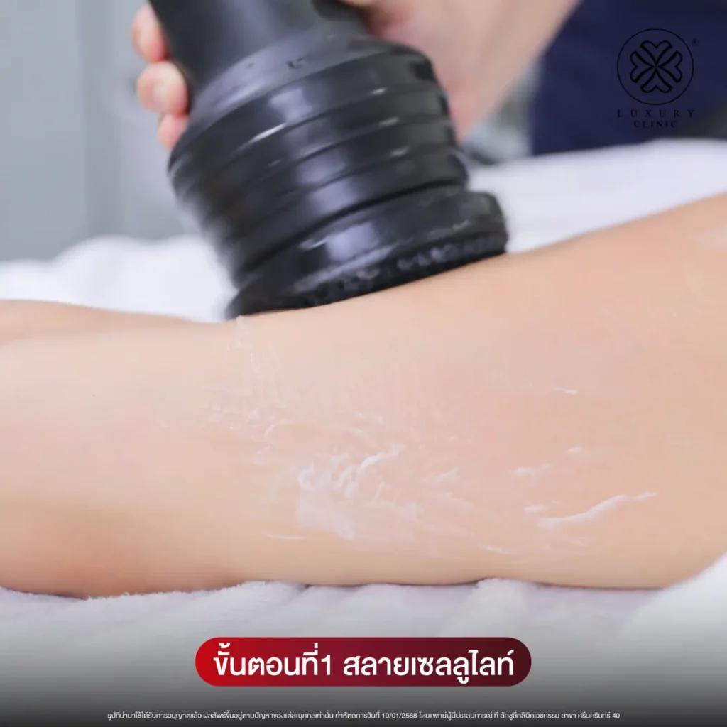 ขั้นตอนที่ 1 สลายเซลลูไลท์