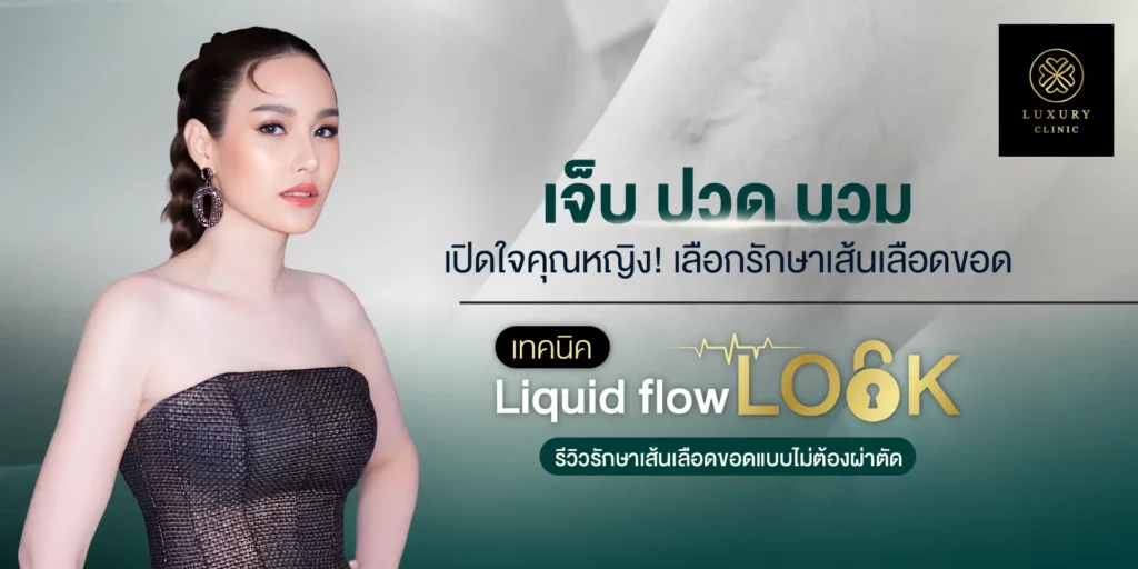 เจ็บ ปวด บวม รักษาเส้นเลือดขอด