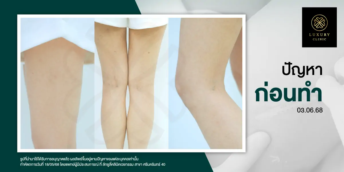 ปัญหาก่อนทำ